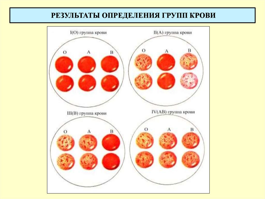 Определение 1 группы крови. Схема определения групп крови по системе АВО. Определение группы крови цоликлонами таблица. Перекрестный метод определения группы крови. Методы определения группы крови физиология.