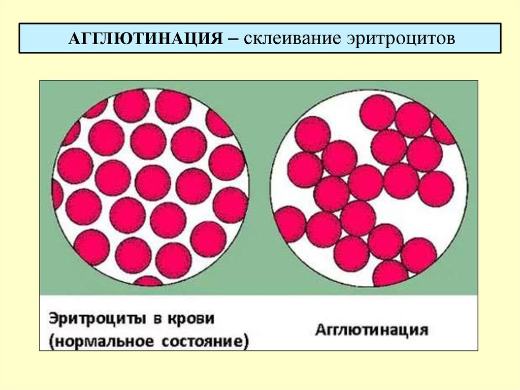 Группа крови агглютинация картинки