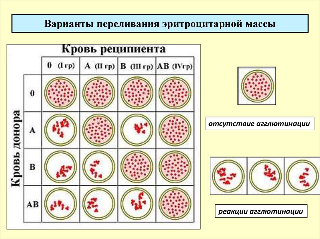 Группы крови биология егэ. Таблица агглютинации групп крови. Схема реакции агглютинации группы крови. Схема переливания крови агглютинация. Агглютинация эритроцитов физиология.