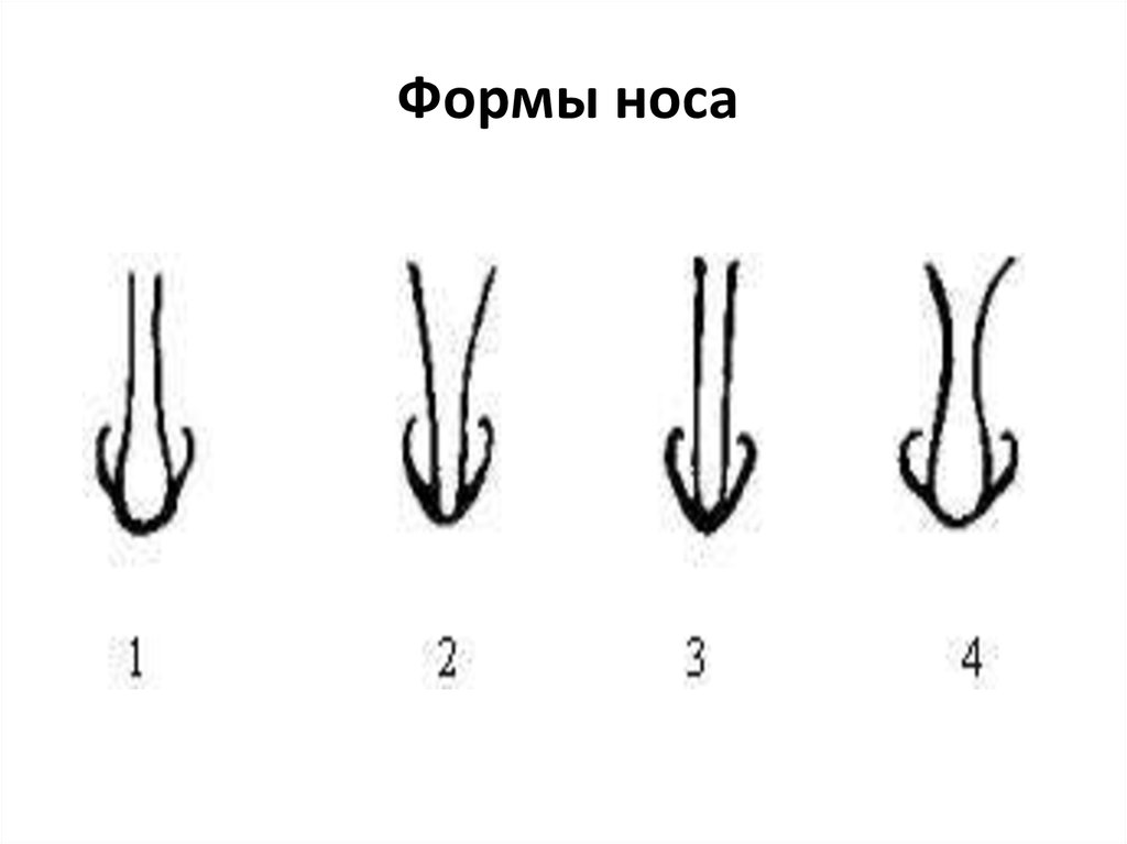 Формы носа. Форма кончика носа криминалистика. Формы Носов. Формы Носов и их названия. Нос криминалистика.