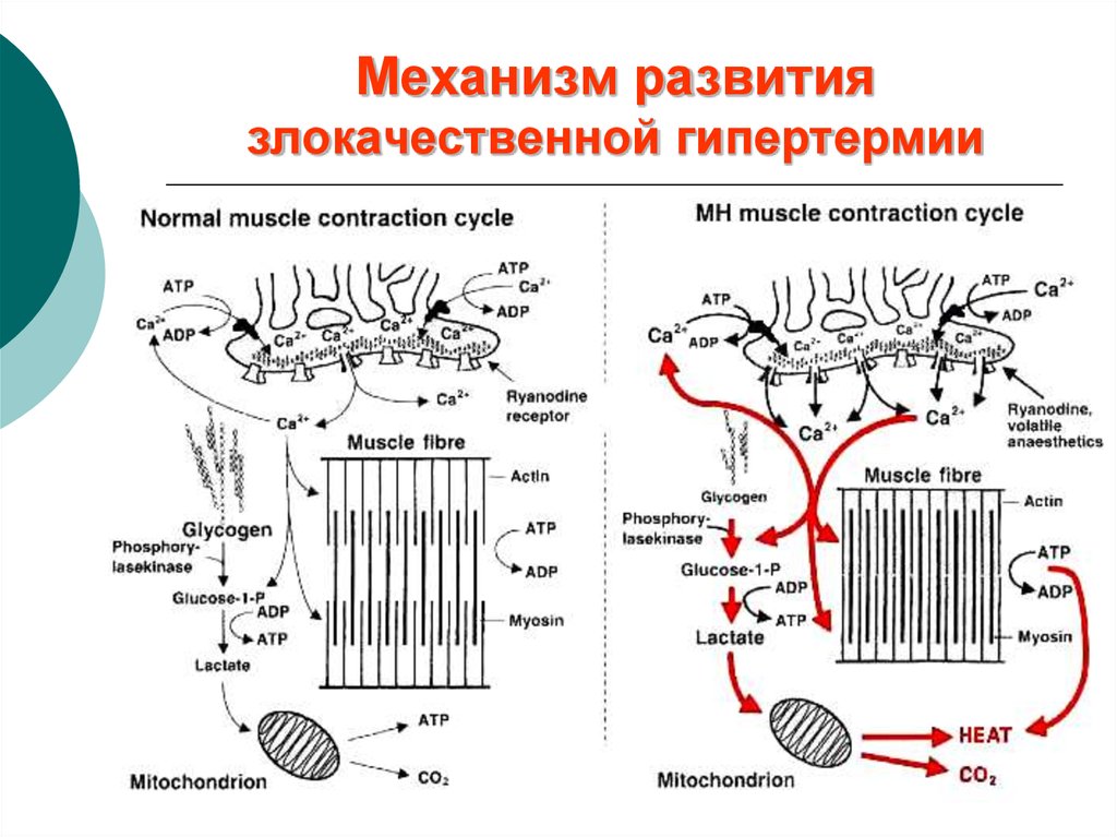 Код гипертермии