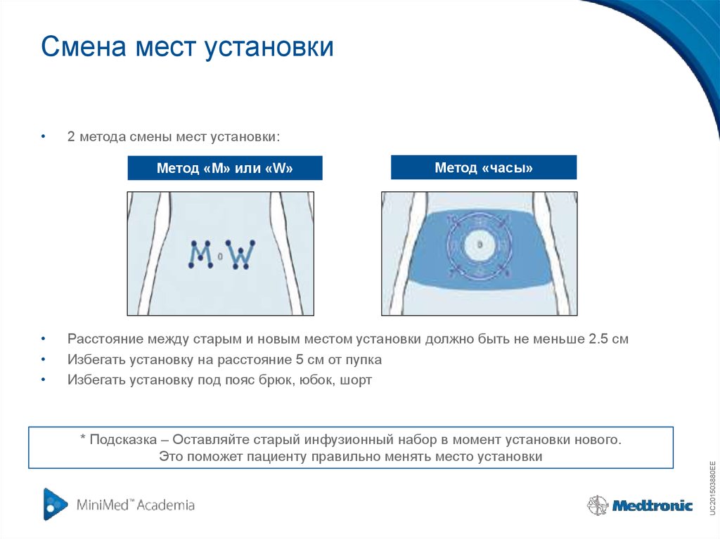 Какое место ставить