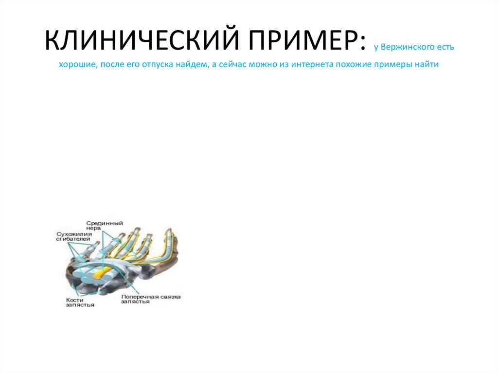 КЛИНИЧЕСКИЙ ПРИМЕР: у Вержинского есть хорошие, после его отпуска найдем, а сейчас можно из интернета похожие примеры найти