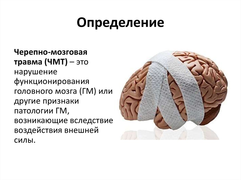 Травматических повреждений мозга. Черепно-мозговая травма. Черепно-мозговая травма определение. Актуальность черепно-мозговой травмы. Черепно-мозговые травмы, сотрясение мозга.