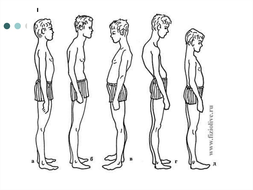 Рассмотрите рисунки 1 4 на каком из них изображен подросток с нормальной осанкой