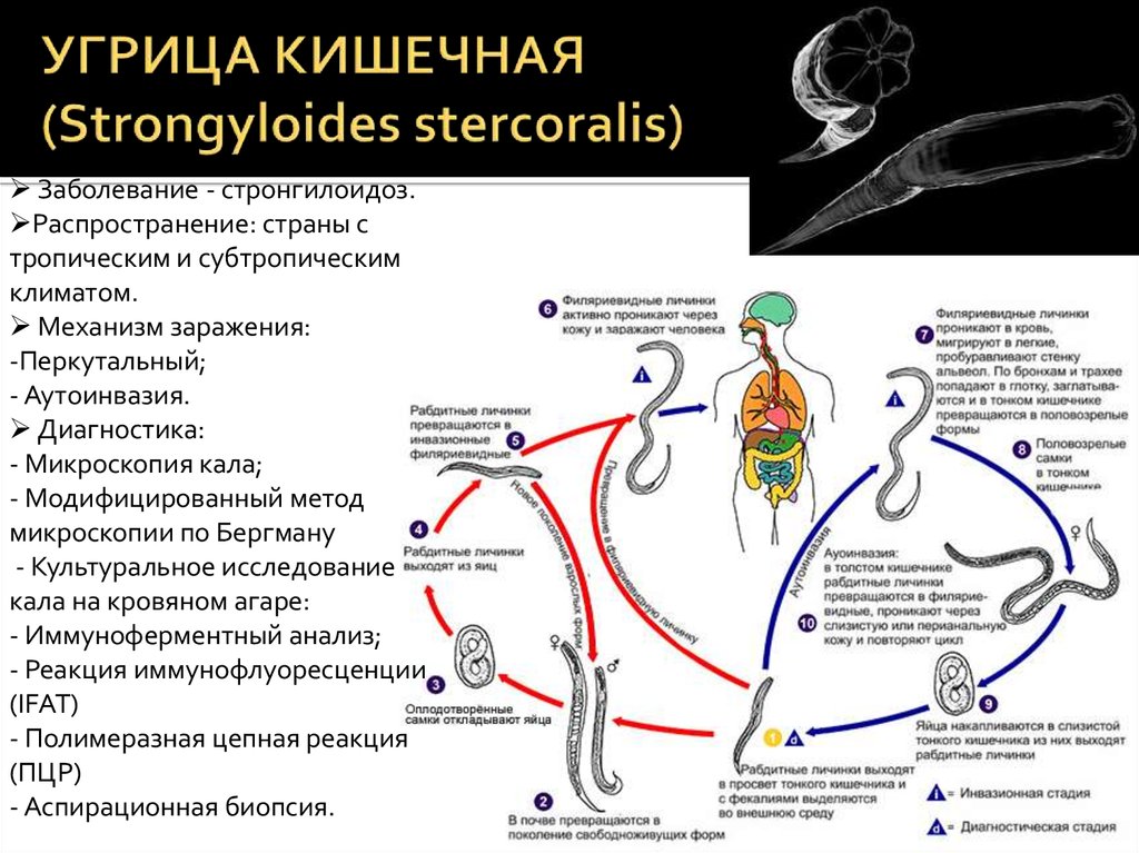 Схема жизненный цикл угрицы кишечной