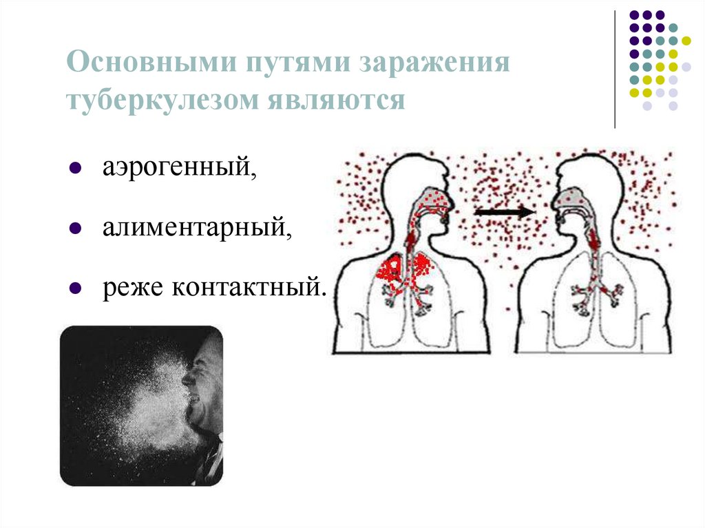 Туберкулез заразен