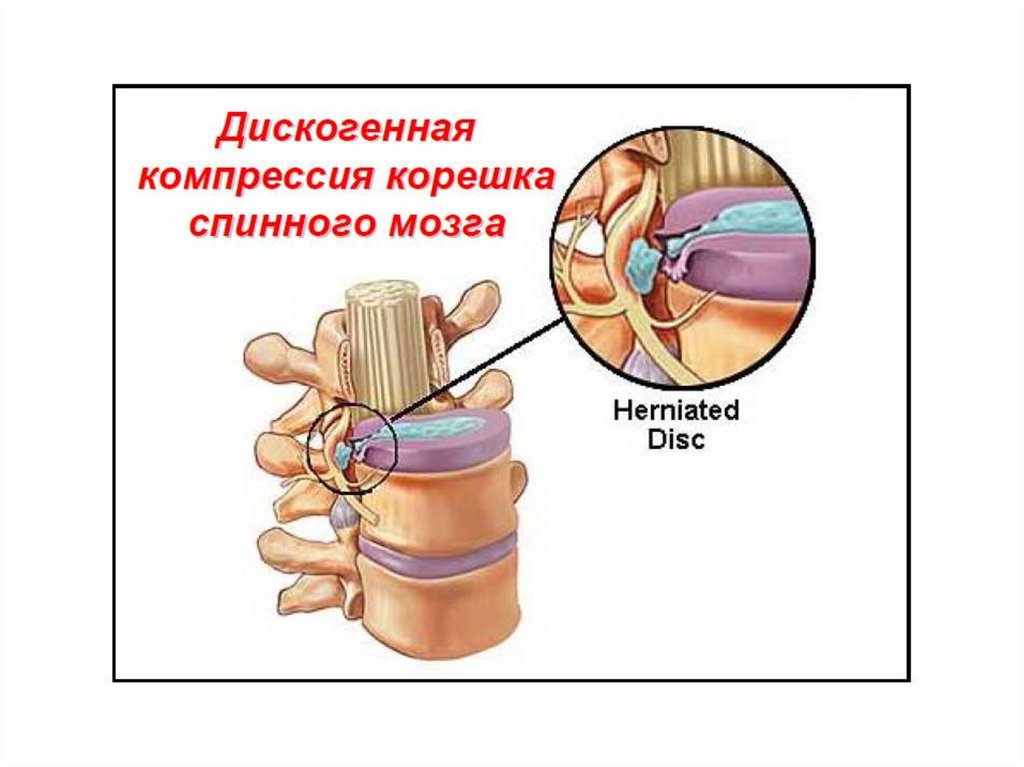 Межпозвонковые корешки