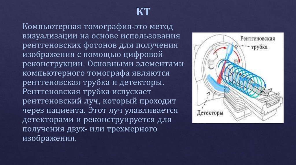 Для получения изображения в компьютерной томографии используется