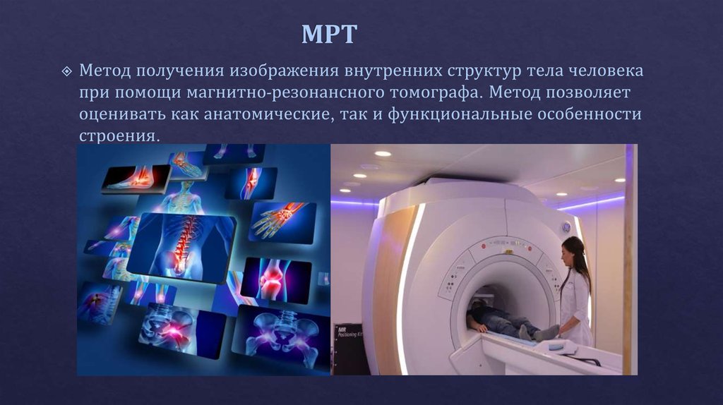 Метод магнитной томографии