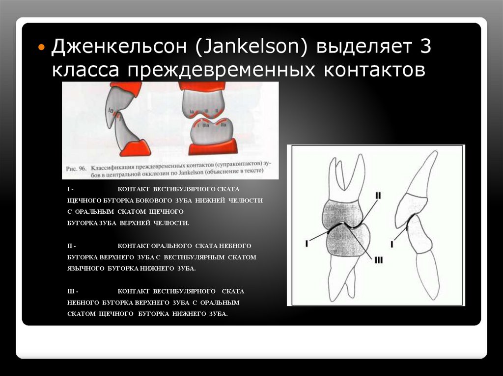 Избирательное пришлифовывание зубов презентация