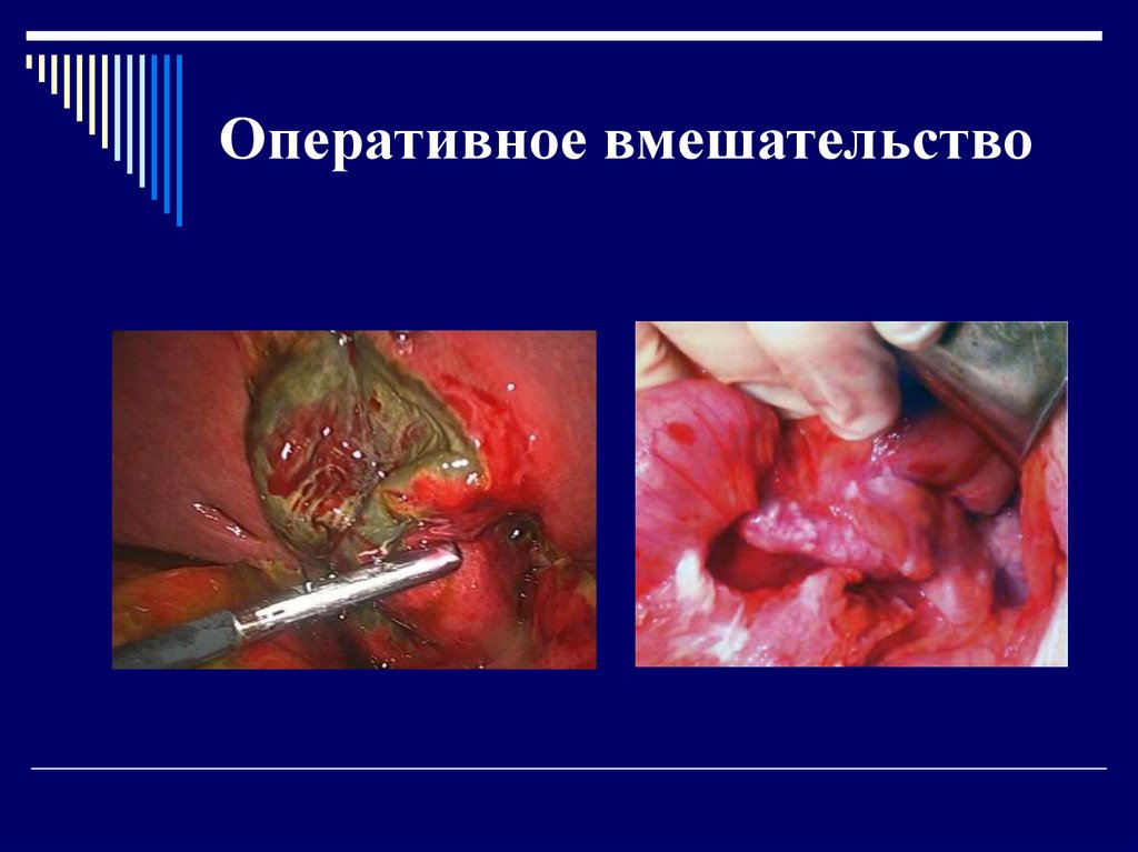 Оперативное вмешательство