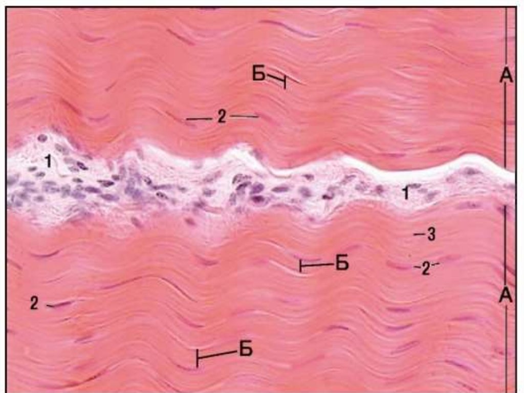 Плотная оформленная ткань сухожилия. Плотная соединительная ткань гистология. Плотная волокнистая оформленная соединительная ткань препарат. Плотная волокнистая соединительная ткань гистология. Плотная соединительная ткань сухожилия.