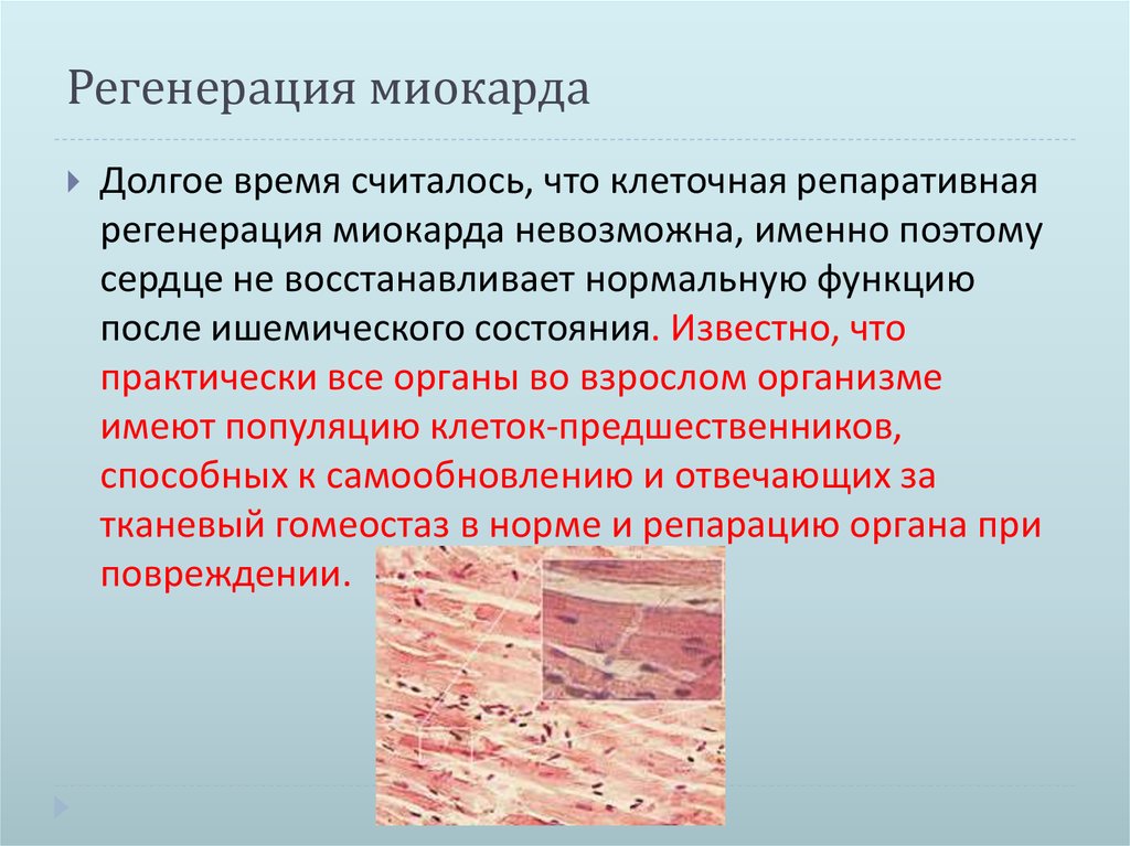 Регенерация миокарда