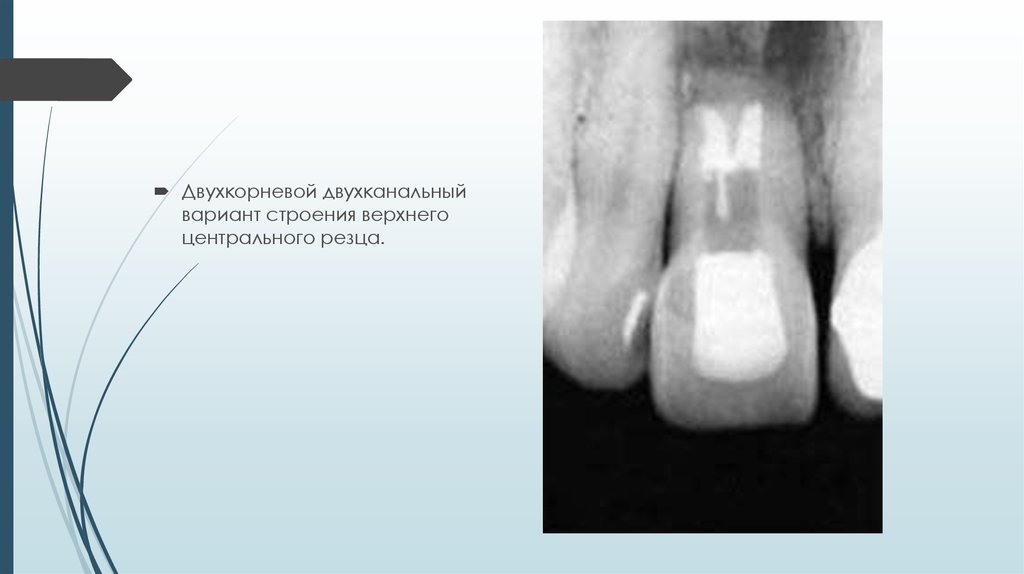 Анатомия корневых каналов презентация