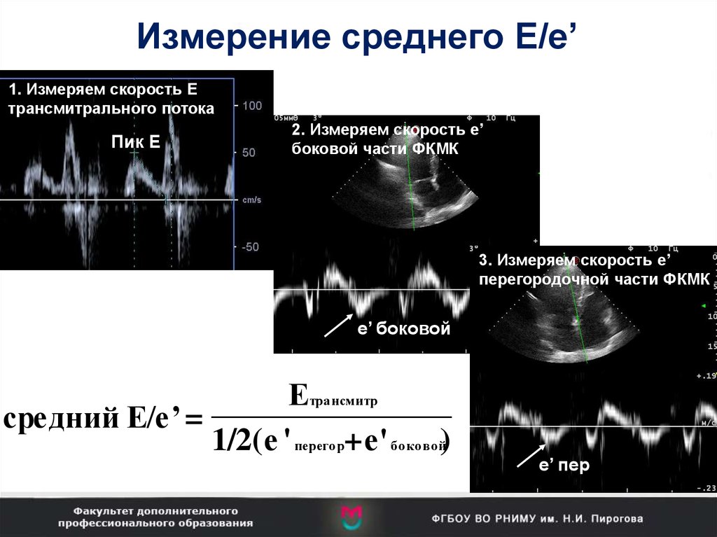 Учебный план эхокардиография