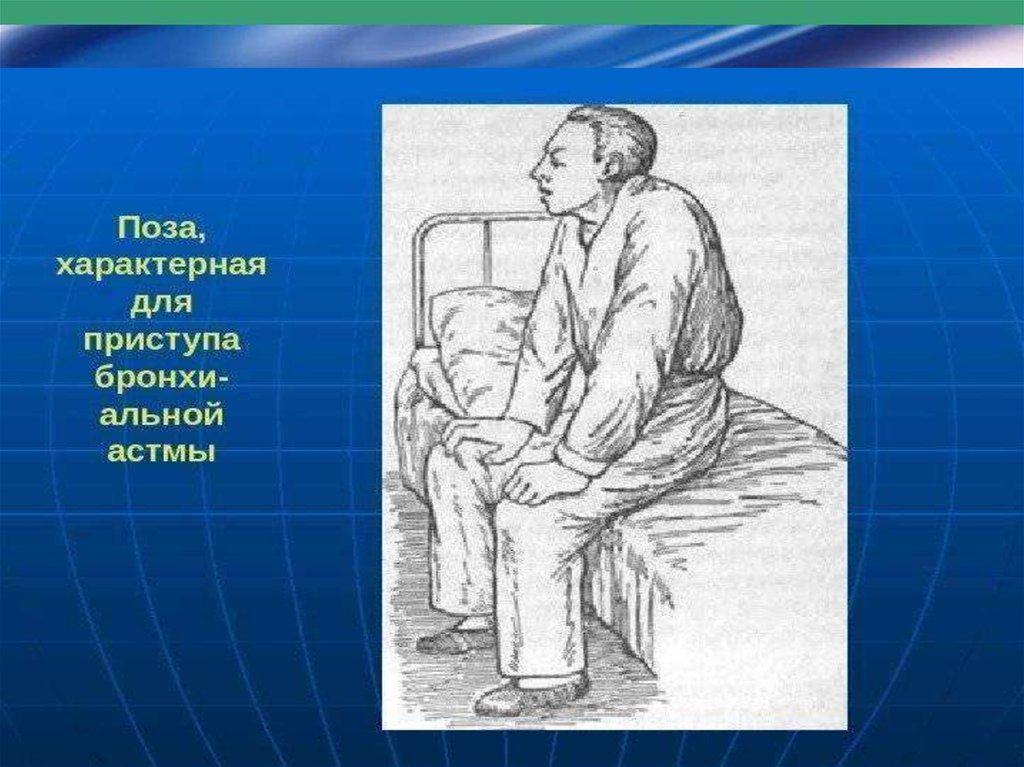 Ортопноэ. Положение ортопноэ у детей. Ортопноэ с фиксированным плечевым поясом.