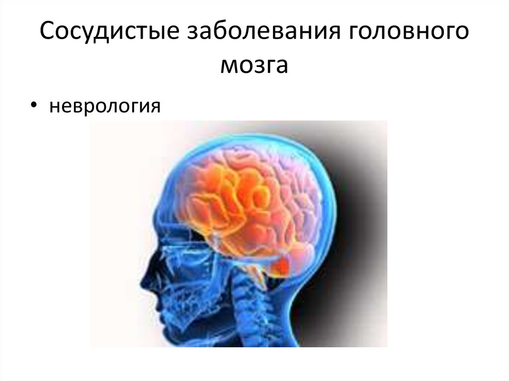 В мозге есть сосуды