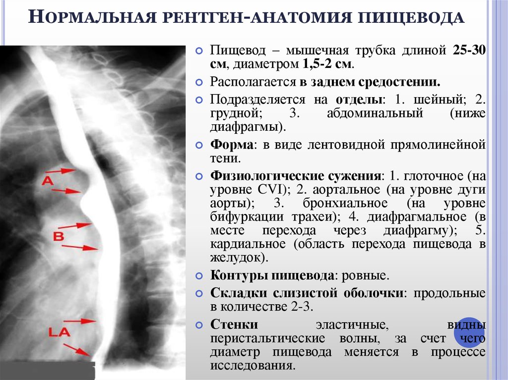 Презентация грыжи диафрагмы