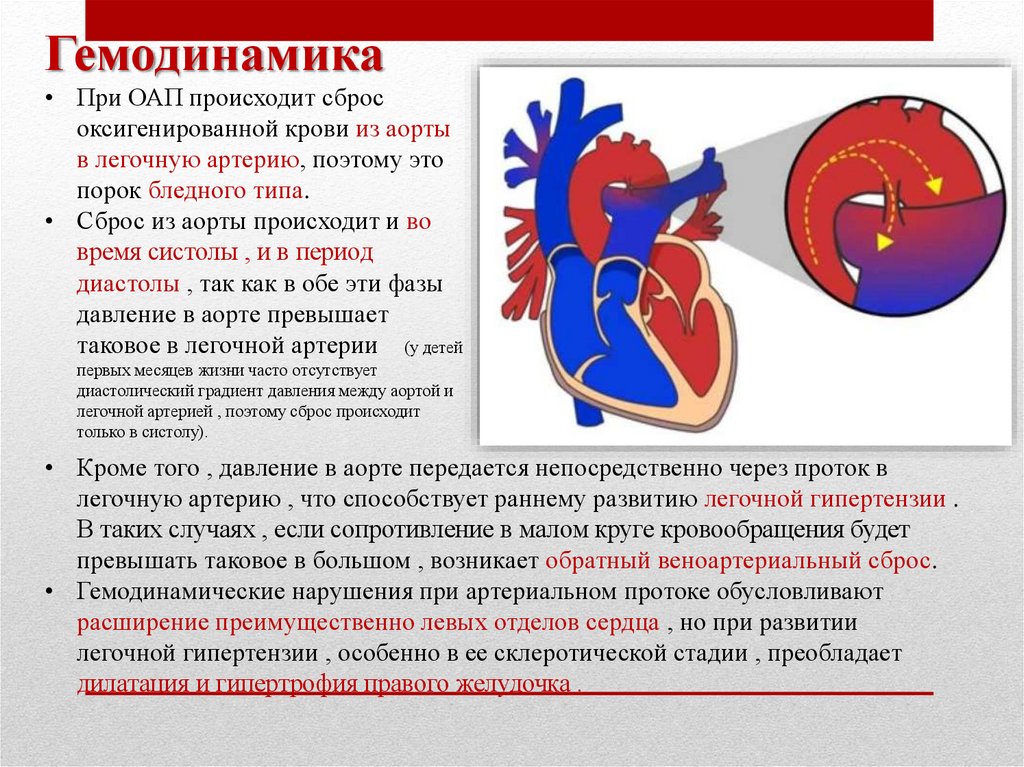 Открытый артериальный проток у детей презентация