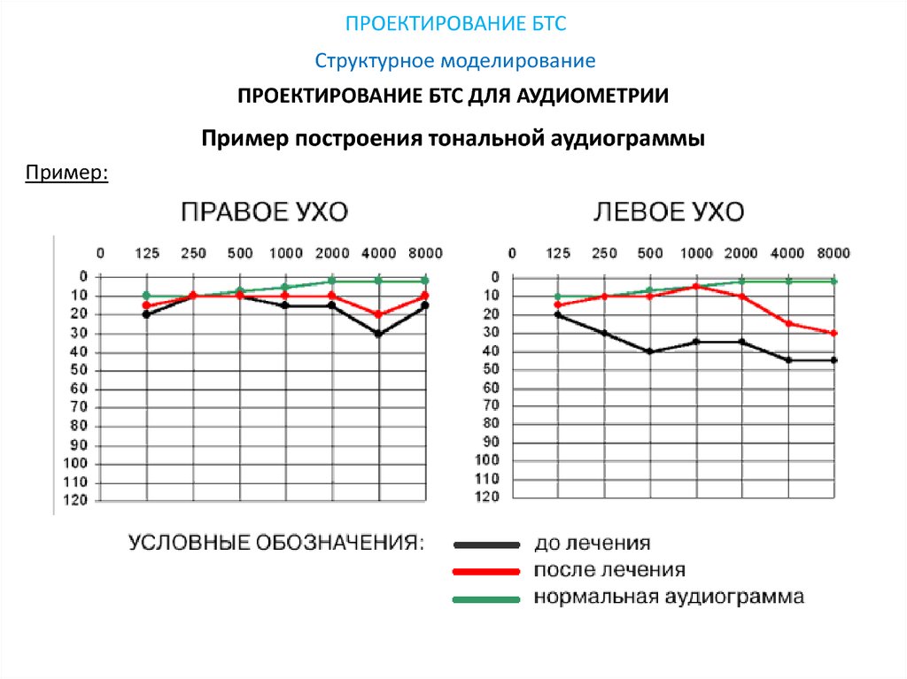 Нормальный слух. Аудиограмма нормальная нормальная здорового человека. Аудиометрия здорового человека норма. Аудиограмма слуха здорового человека. Аудиограмма здорового человека график.