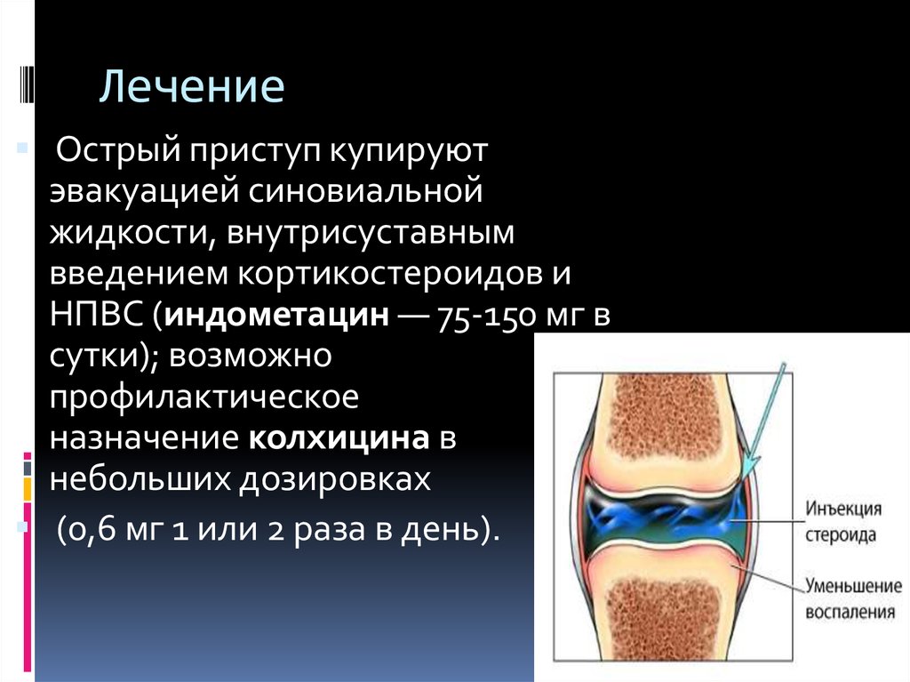 Синовиальная суставная жидкость. Скопление синовиальной жидкости в коленном суставе. Жидкость между суставами колена. Жидкость вырабатываемая железа
