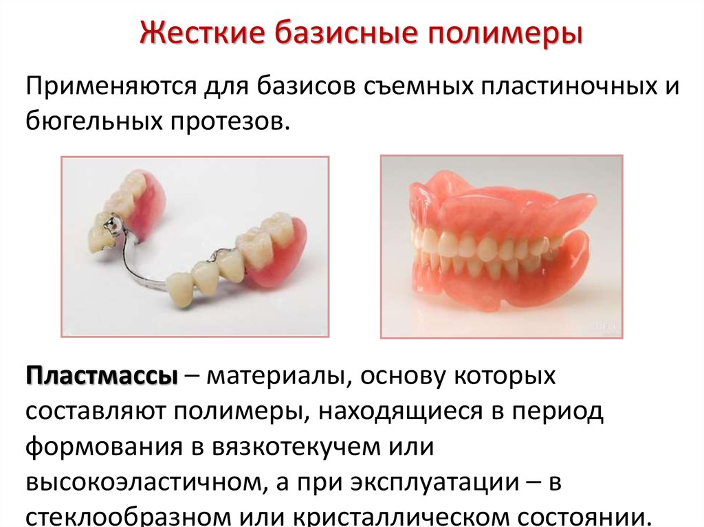 Показания к пластиночным протезам. Жесткие базисные полимеры. Классификация пластмасс в ортопедической стоматологии. Базисные пластмассы в стоматологии. Пластмассы для съемного протезирования.