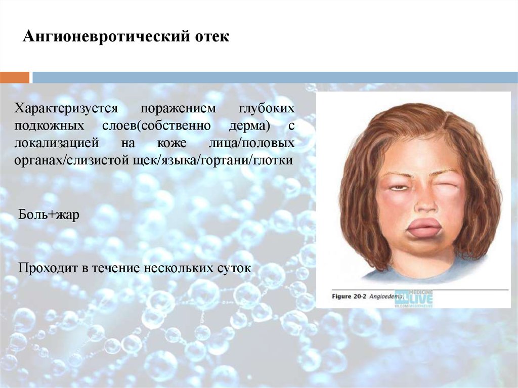 Реакции гиперчувствительности кожи (CDHR). Реакции гиперчувствительности  кожи к лекарствам (DHR) - презентация онлайн