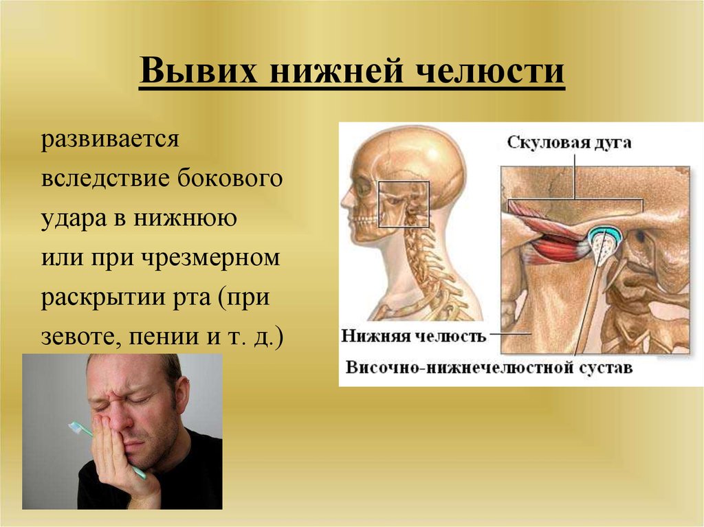 Вывих нижней челюсти карта вызова