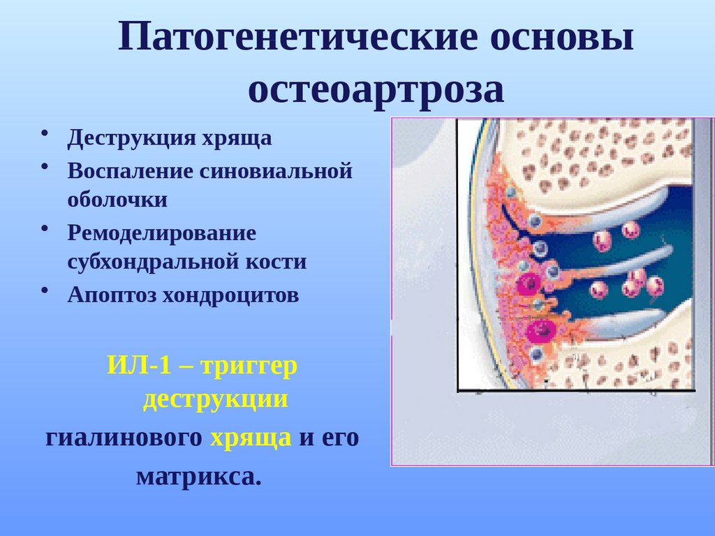 Патогенетические основы остеоартроза
