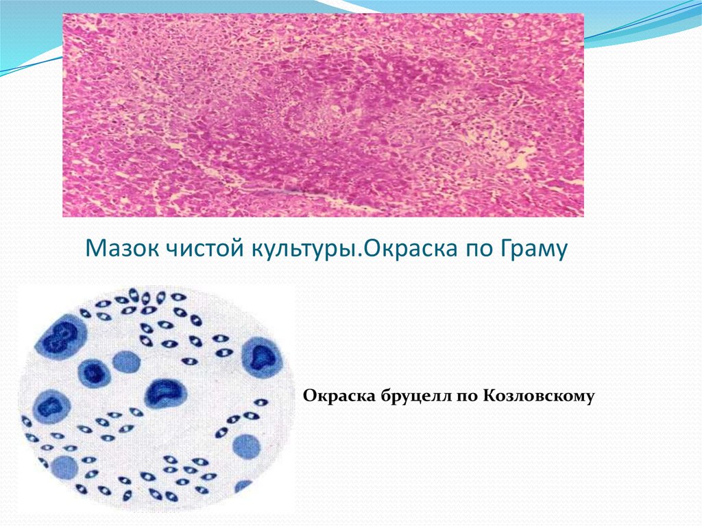 Бруцелла. Бруцеллез. Микробиология - online presentation