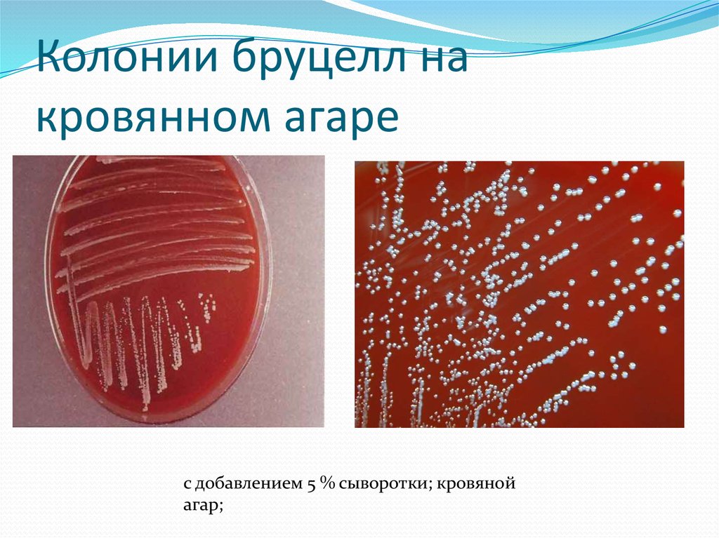 Бруцелла. Бруцеллез. Микробиология - online presentation
