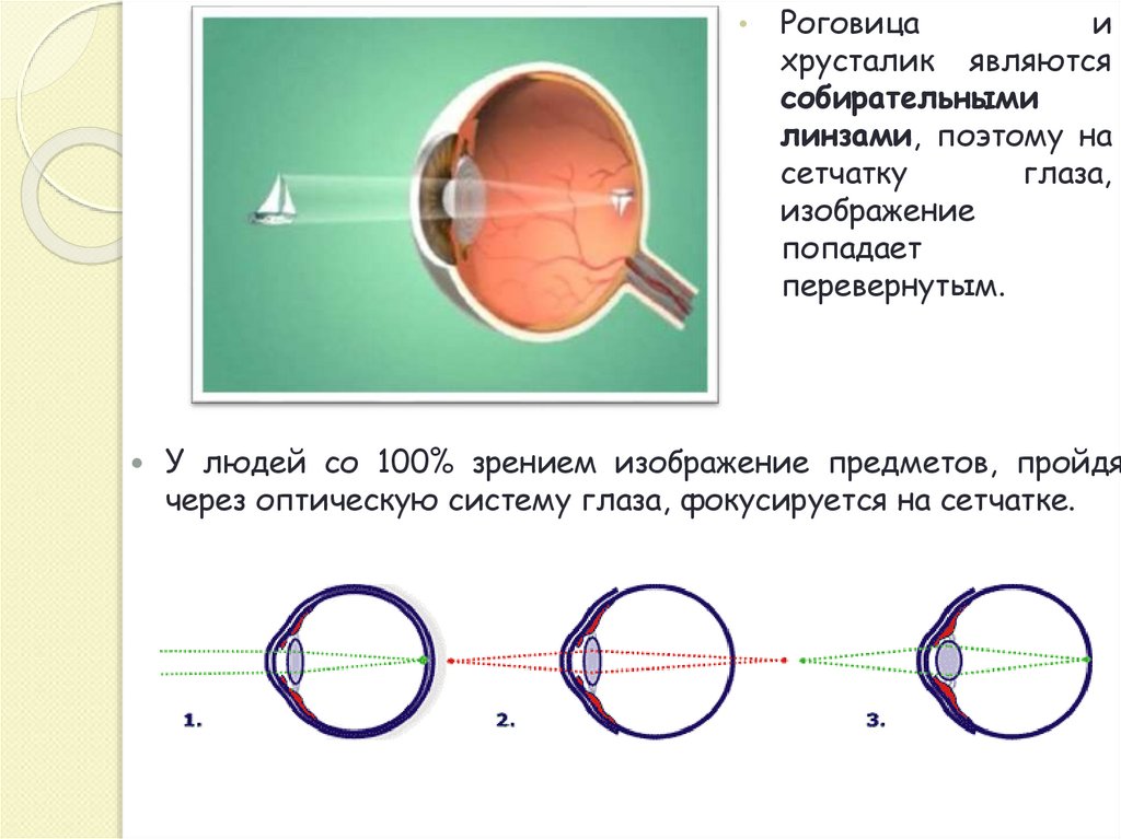 Очки для аккомодации глаз. Схема очков. Аккомодация глаза схема. Глаз и очки схема. Сложный гиперметропический астигматизм глаз