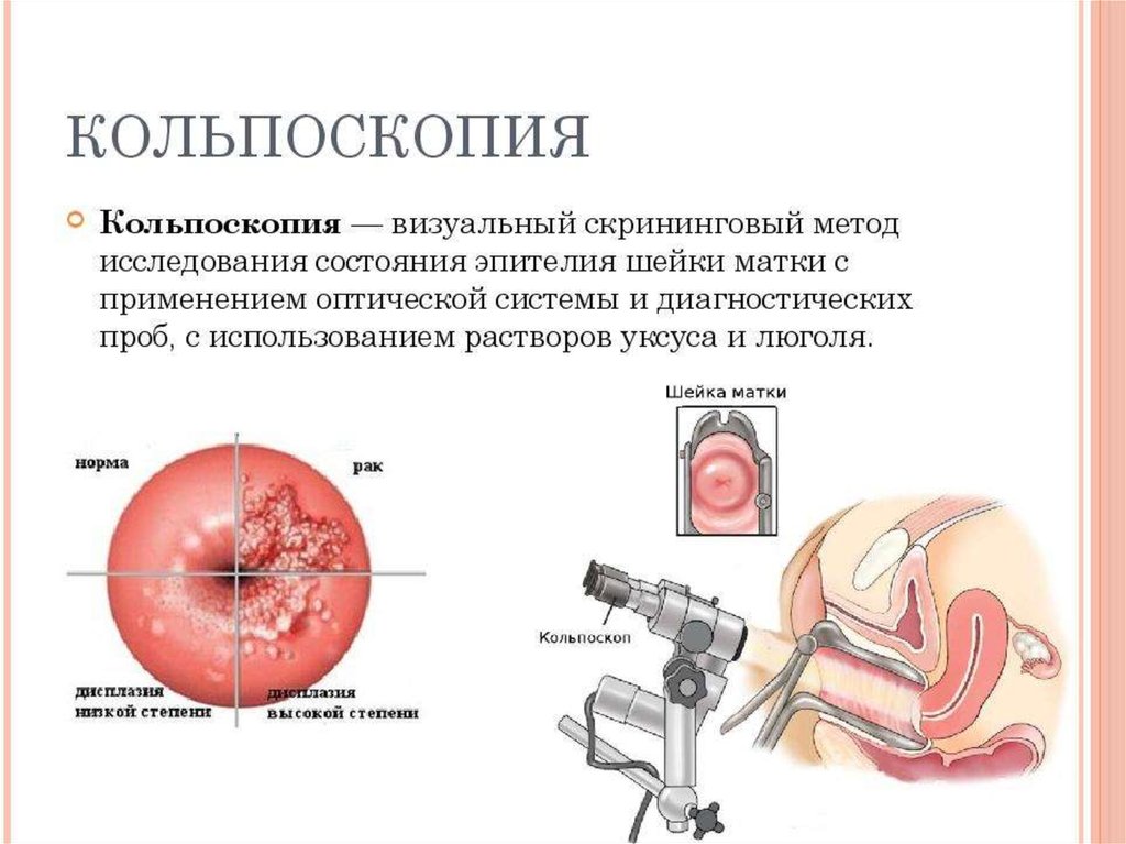 Инструментальные методы исследования в гинекологии