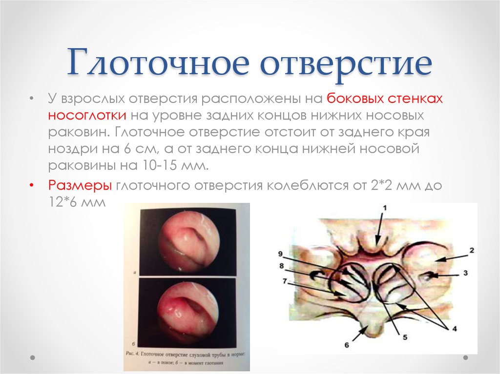 Глоточное отверстие