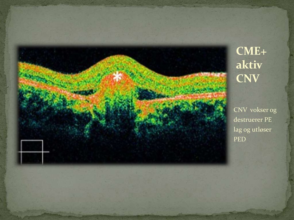 CME+ aktiv CNV