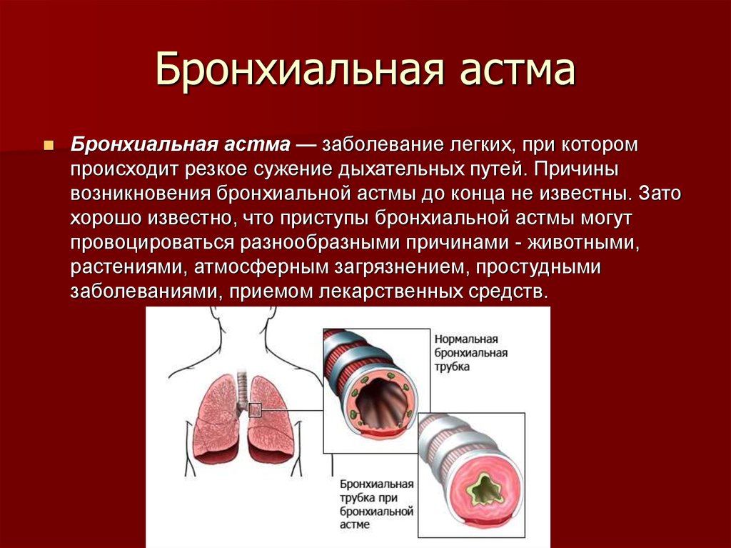 Бронхиальная астма картина