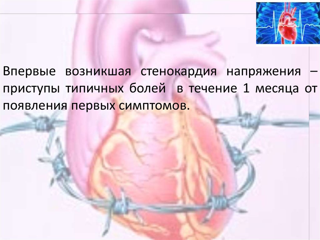 Стенокардия картинки для презентации