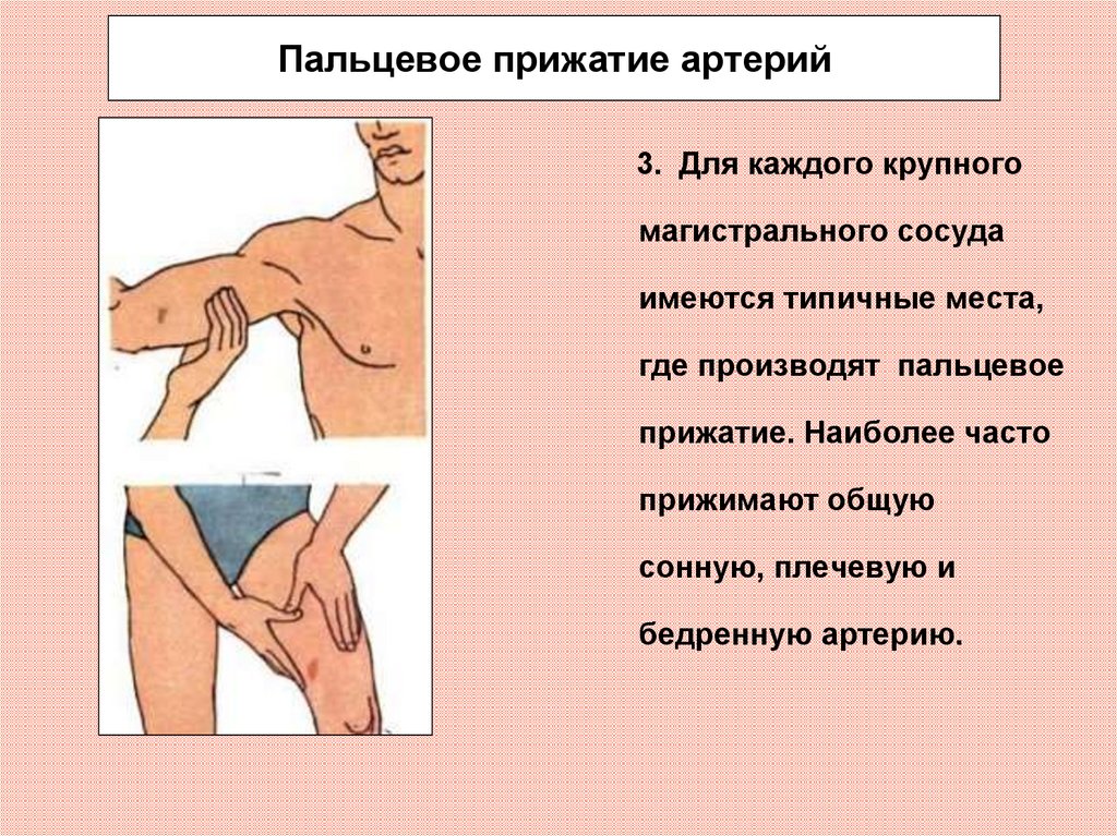 Повреждение пальцевой артерии