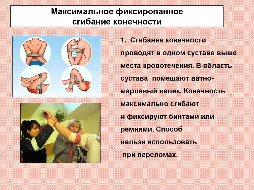 Максимальное сгибание конечности. Фиксированное сгибание конечности. Максимальное фиксированное сгибание конечности в суставе. Максимальное сгибание конечности осложнения. Максимальное сгибание конечности в суставе при кровотечении.