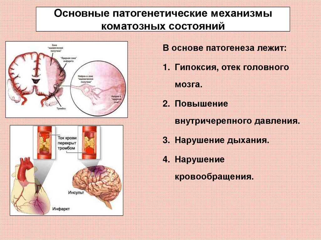 Патогенетические механизмы