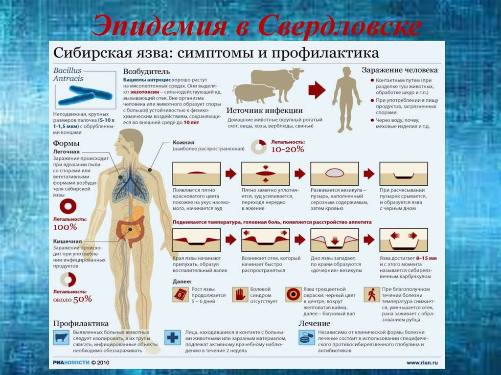 Эпидемия в Свердловске
