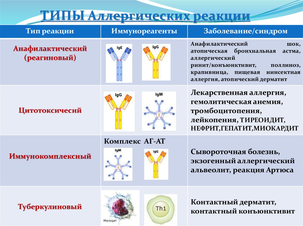 Типы аллергических заболеваний. Классификация аллергических реакций по патогенетическому принципу. Аллергический Тип личности.