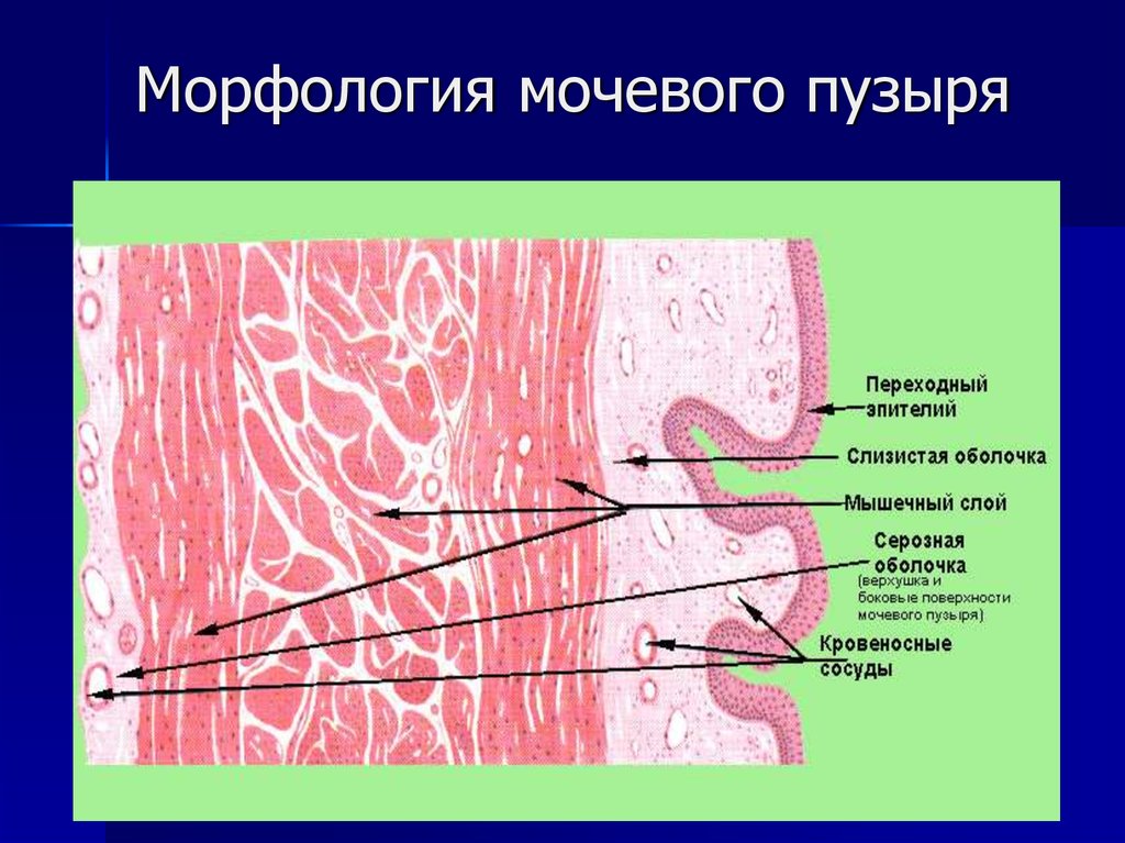 Стенка пузыря