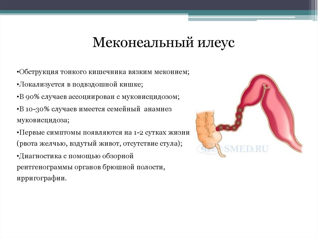 Кистозный фиброз презентация