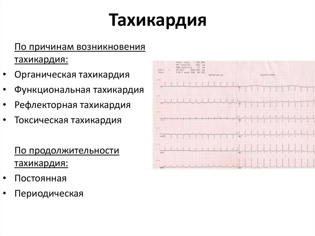 Учащенное сердцебиение причины