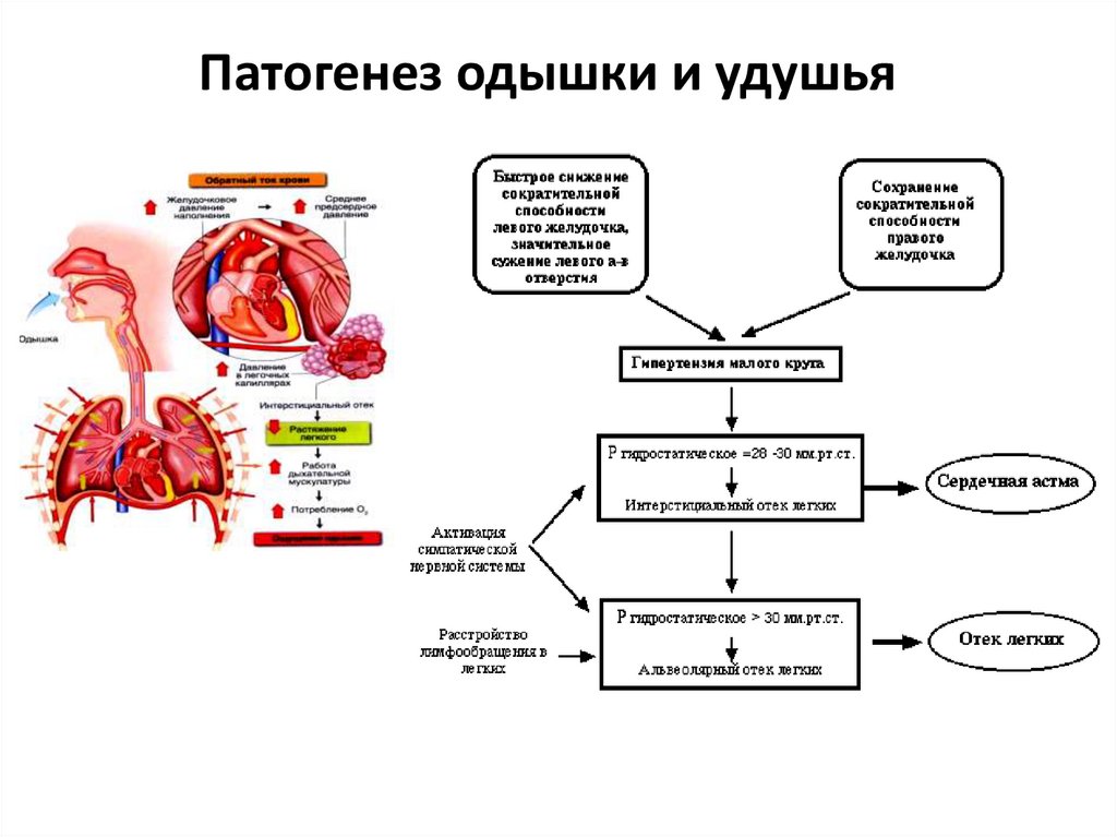 Дыхание при сердечной недостаточности. Механизм развития одышки при дыхательной недостаточности. Одышка механизм развития при заболевании сердца. Патогенез сердечно-сосудистой недостаточности. Механизм развития одышки патофизиология.
