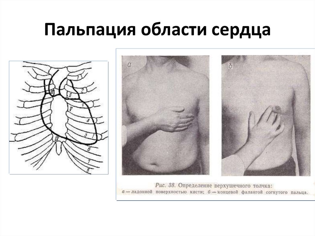 Перкуссия сердца в картинках