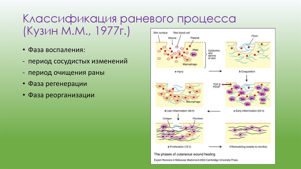Классификация раневого процесса (Кузин М.М., 1977г.)