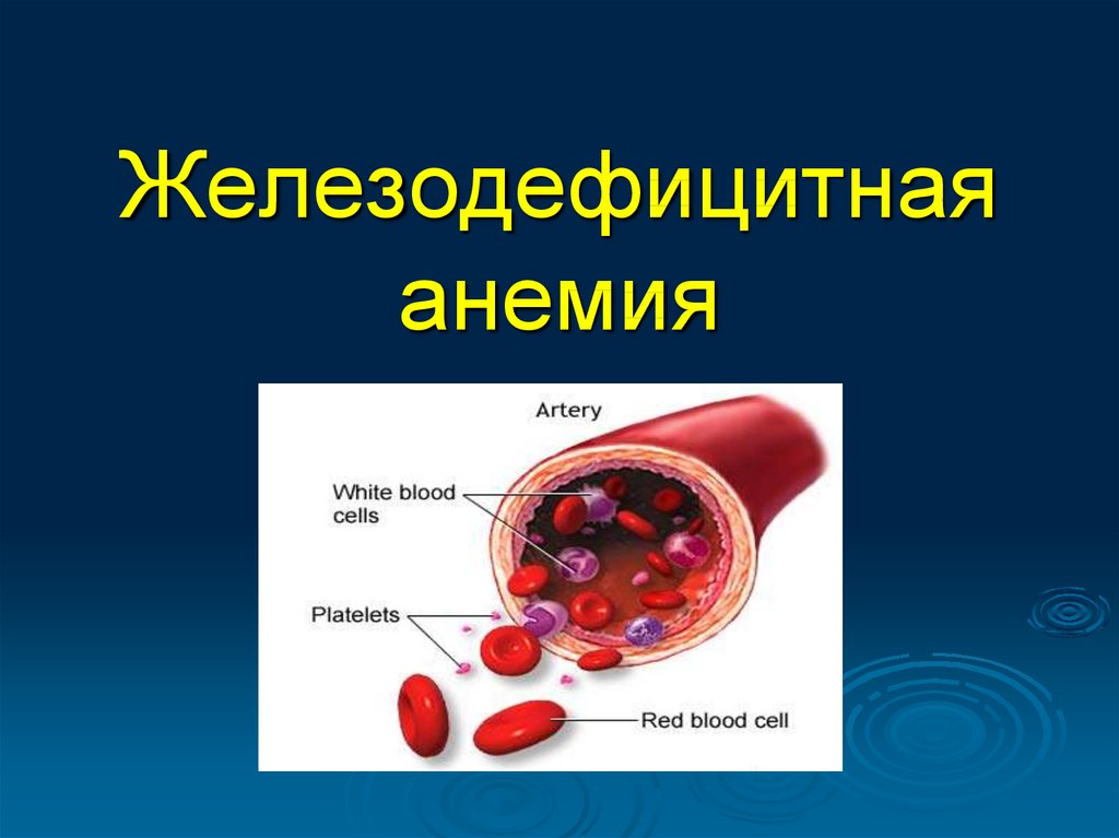 Железо дефицитная анемия